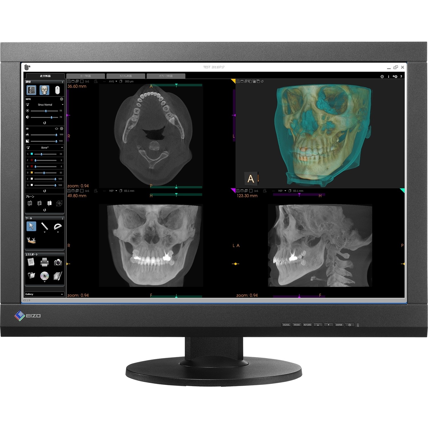24palcový EIZO monitor 2,3MP DICOM