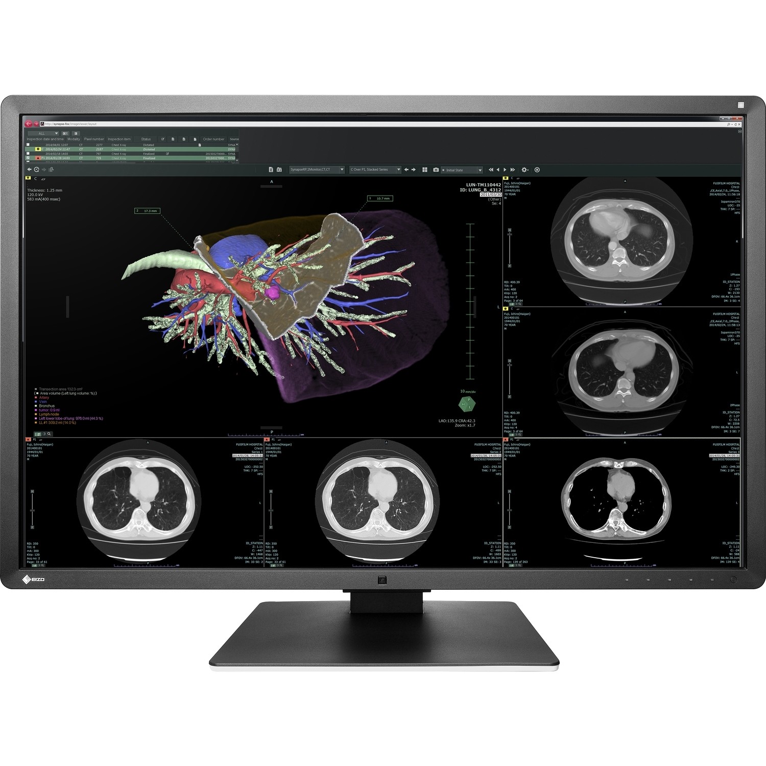 EIZO RadiForce RX660