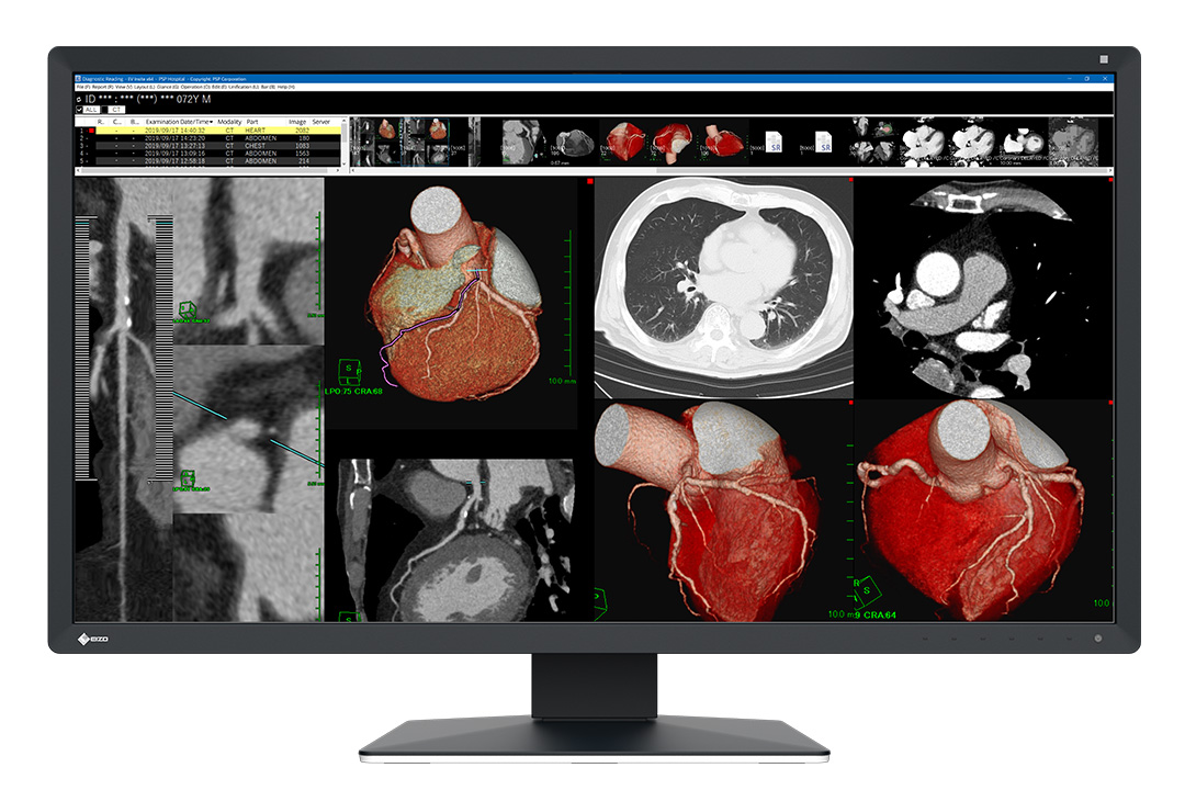 EIZO RadiForce MX317W