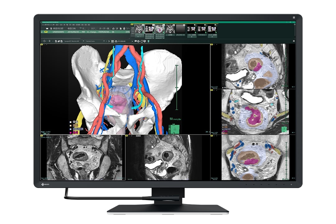 EIZO RadiForce RX670